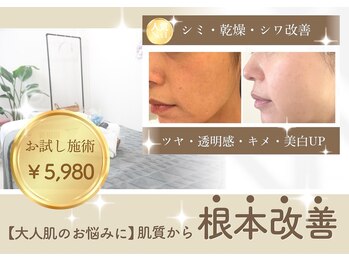 ラナビューティリゾート(Lana Beauty resort)の写真/【40代からのシミ・シワ・たるみ専門】大人女性の肌悩みに寄り添う、肌質改善フェイシャル◎