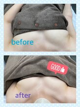 ドマーニプラス 泉店(DOMANI PLUS.)/ブライダル前にバストケア