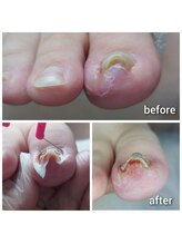 爪切り屋 足楽/オルトグリップシュパンゲ