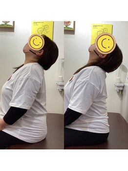 ヒデ整体院(Hide整体院)/首こり肩こり猫背巻き肩骨盤矯正