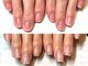 ビビネイル(BIBI Nail)の写真/【美爪育成サロンの本格爪育プランが大人気!!】教育関係・飲食系・お爪にコンプレックスをお持ちの方必見☆