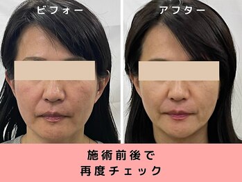 あぐり鍼灸整骨院/施術変化