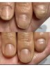 《自爪育成》ささくれ予防集中ネイルケア