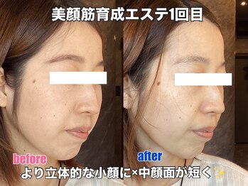 リエル(RIEL)/【美顔筋育成】