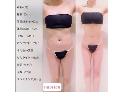エモーション 横浜関内店(Emotion)の写真
