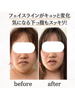 ヨサパーク シアー(YOSA PARK sheer)/お客様の声