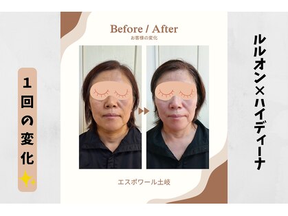 ヨサパーク エスポワール 土岐店(YOSAPARK espoir)の写真