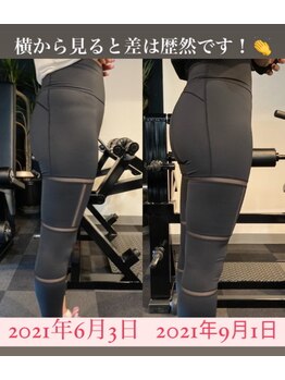 ネクストジム 京都西院店(NEXT GYM)/女性3/運動成果[筋トレ/ヒップ]