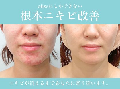 オリス 名古屋店(oliss)の写真