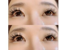 ユーアンドワイ(Yu&Y)/バインドロック