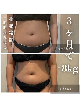 サロン ルイス アディクト(salon Lewis Addict)/小顔ハイアールエフウェーブ!