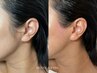 【もみあげワックス脱毛】横顔を美しく魅せたい方、洗練された横顔に