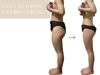 ヨサパーク 温美(YOSA PARK)/とにかく見た目痩せがスゴい！