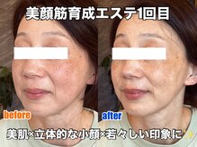 リエル(RIEL)/【美顔筋育成】