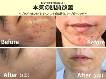 くつろぎ処癒家/オーダーメイドフェイシャル