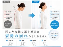 鍼灸ハリカラ