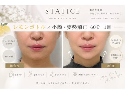 スターティス(STATICE)の写真