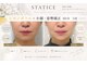 スターティス(STATICE)の写真
