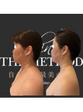 エミナル(EMINALu)/結果☆面長や顔幅も最小へ