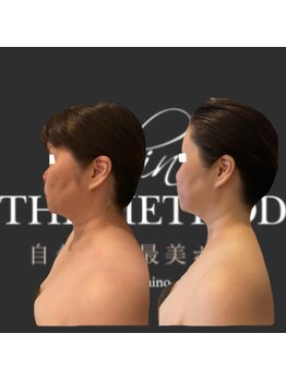 エミナル(EMINALu)/結果☆面長や顔幅も最小へ