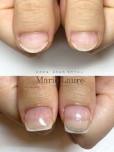 マリーロール 淀屋橋本店(Marie Laure)/自爪育成/深爪矯正/ネイルケア