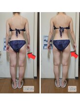 ヨサパーク ジジ(YOSA PARK ZiZi)/水素酸素吸入でお尻が小さく！