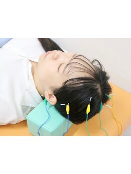 鍼灸施術を受けたい