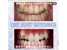 ライトビューティー 本八幡店(LIGHT BEAUTY)/お客様ビフォーアフター♪ 