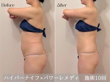 ティセラ(TISERA.)の雰囲気（根本改善し痩せにくく健康的な身体へ！姿勢改善まで可能に◎）