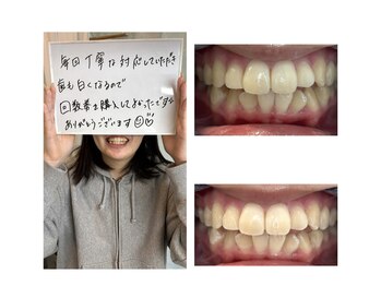 ホワイトニング美白ラボ 筑西店(ホワイトニング美白LAB)/