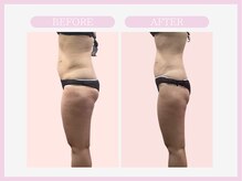 スリムライン 秋田店(The Slim Line)/before→after