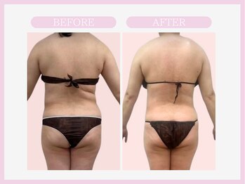 スリムライン 弘前店(The Slim Line)/before→after