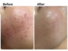 ムーロ バイ ミュー(muro. by mieux)/Before After