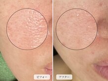 スローガーデン(Slow Garden)/ハーブ×炭酸