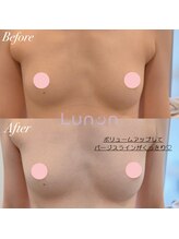 ルノン(Lunon)/【20代・ブラが浮く】バストケア