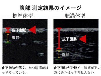 Julien千葉店【オーダーメイド痩身】ダイエット/美脚/全身痩せ/脂肪の厚みを測定/千葉/新千葉