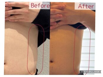 リンパセラピーファシル(Facile)の写真/REDショット導入キャビで叶える！お腹・足・腕・背中のリンパを流してスッキリ♪
