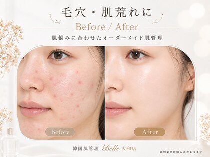 ベル 大和(Belle)の写真
