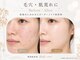 ベル 大和(Belle)の写真