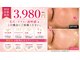 アンテグラールの写真/小顔を目指すサブスク誕生！丁寧なリフトアップと毛穴ケアで理想の自分へ★月額9,980円通いたい放題！