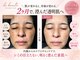 ドゥ ボーテ(de beaute)の写真