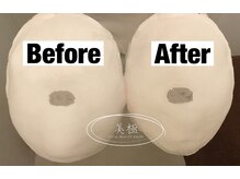 美極 トータルビューティー(美極 TOTAL BEAUTY)/恵比寿/小顔コルギ/エステ/