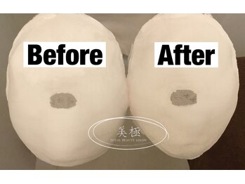 美極 トータルビューティー(美極 TOTAL BEAUTY)/恵比寿/小顔コルギ/エステ/