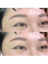 アーティカル(Artical)/アイブロウリフト