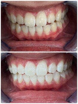 シャイニー 仙台駅東口(SHINY)/お客様の変化