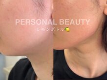 PB/レモンボトル