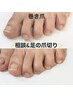 【巻き爪】相談＆足の爪切り　2,200円