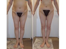 クレビア 神保町 水道橋(CREBIA)/ダイエット／痩身サロン