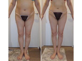 クレビア 神保町 水道橋(CREBIA)/ダイエット/痩身サロン