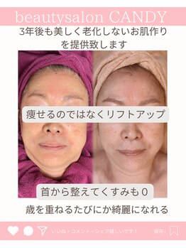 ビューティーサロン キャンディ 海老名(Candy)/